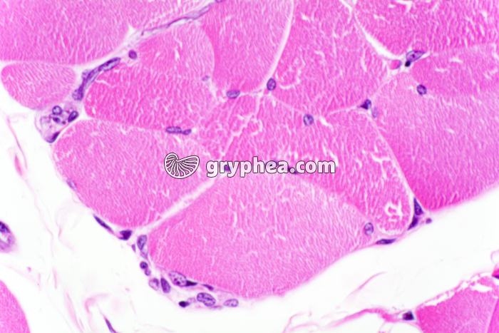 Muscle strié CT x200 - gryphea.com